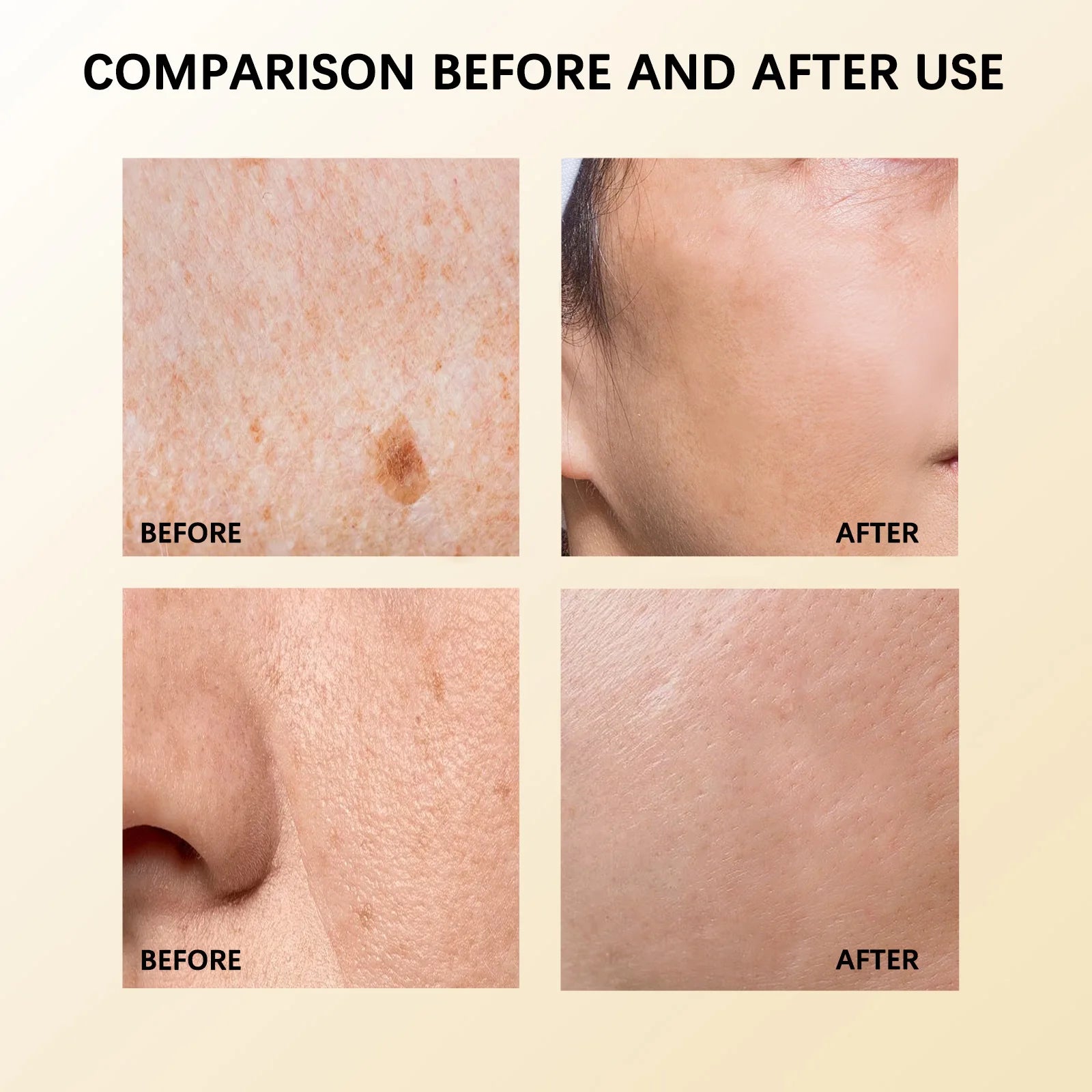 Body Care Cream Deep Hydration Moisturize Smooth Skin Soothe Discomfort External Use Massage Daily Body Skincare